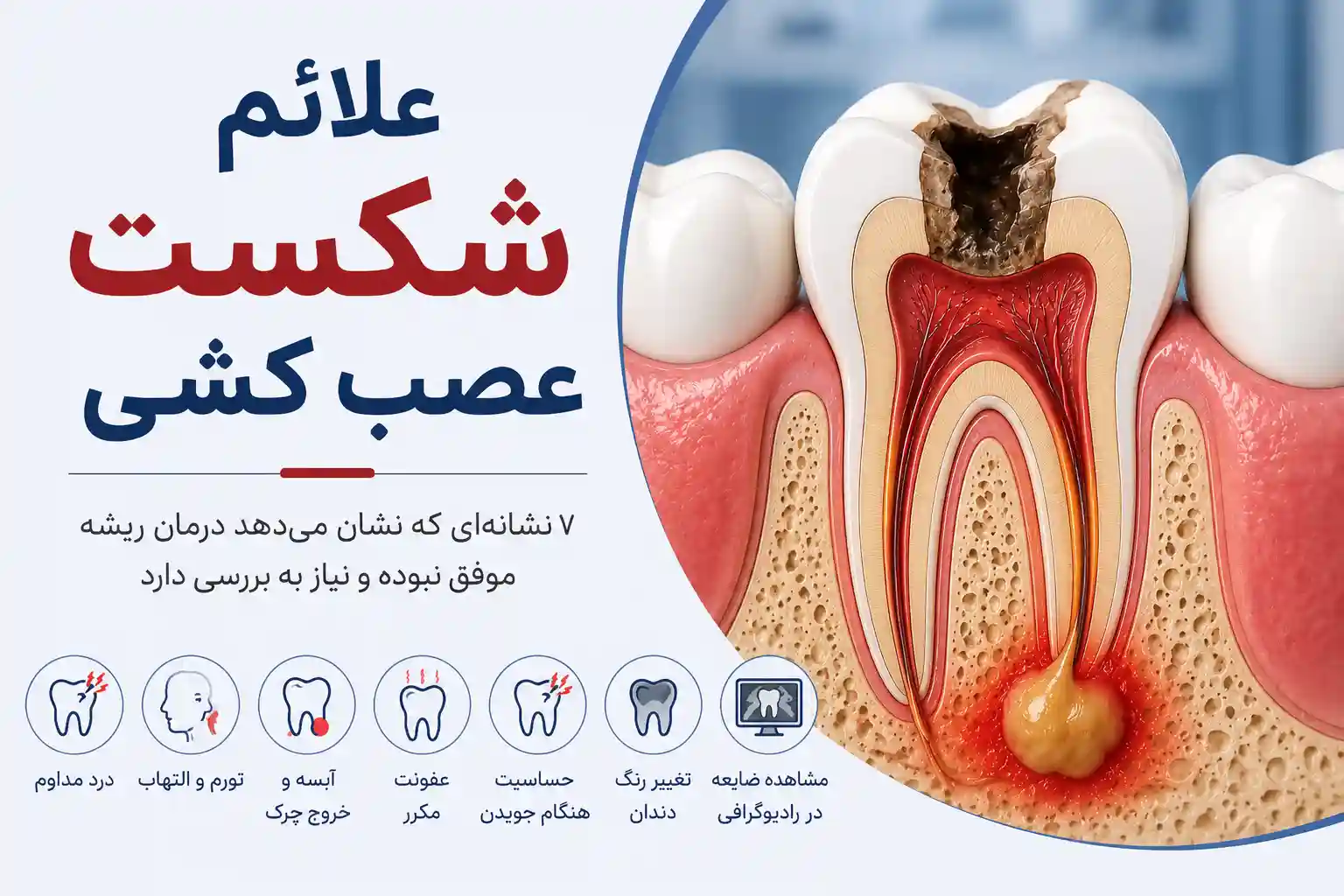 علائم شکست عصب کشی