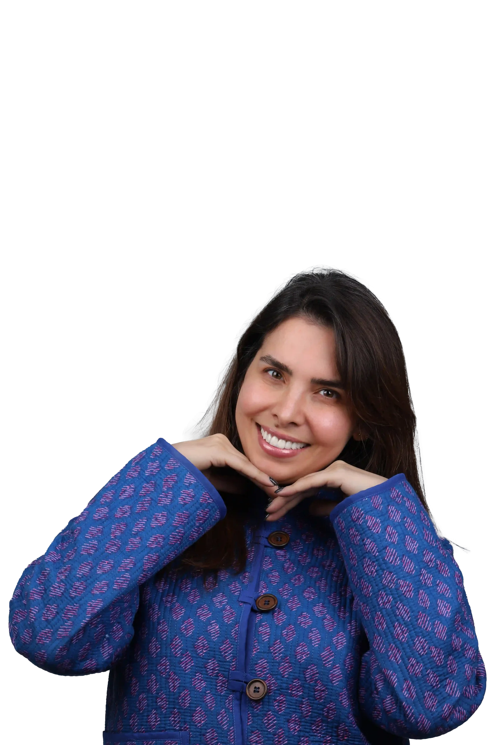 نمونه کار لمینت دندان